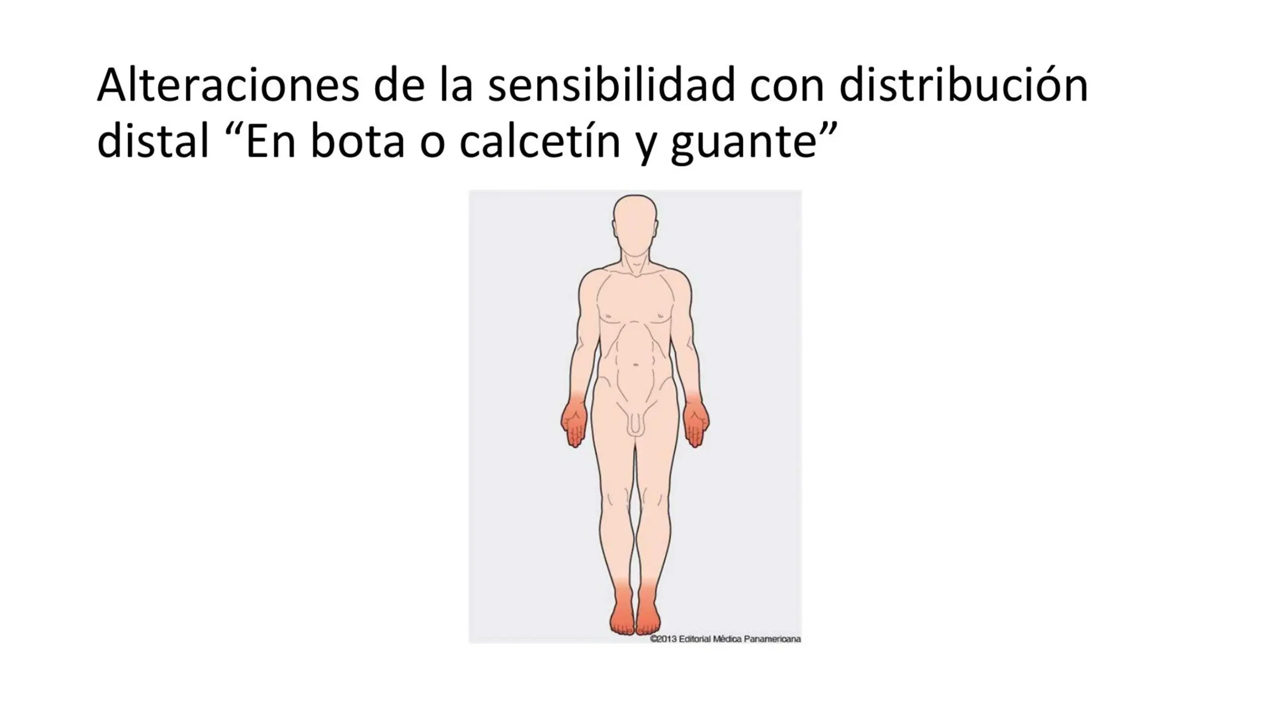 Alteración de la sensibilidad en bota y guante: Causas, síntomas y tratamiento - Cómo se llama la pérdida de sensibilidad alteracion de sensibilidad en bota y en guante - Cómo se llama la pérdida de sensibilidad