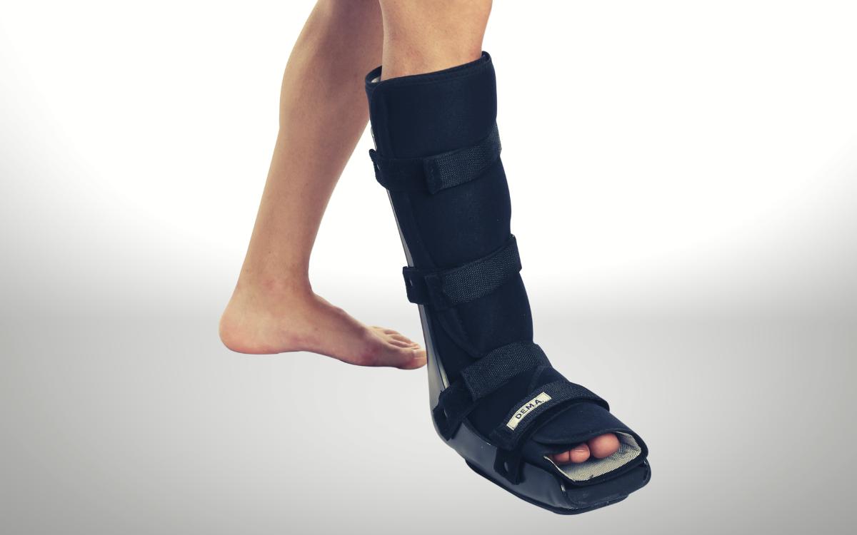 La bota Walker y el edema de tobillo: Causas, prevención y tratamiento - Cuánto tarda en irse un edema en el tobillo la bota walker provoca edema de tobillo - Cuánto tarda en irse un edema en el tobillo