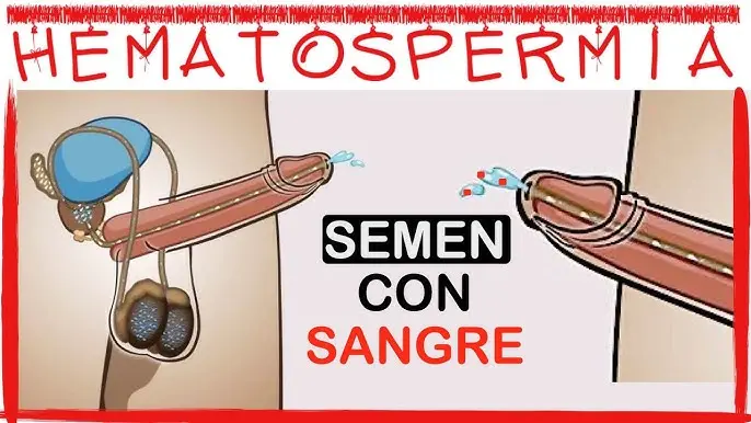 el hombre con la bota sangre cuando eyacula - Qué pasa si el esperma toca la sangre